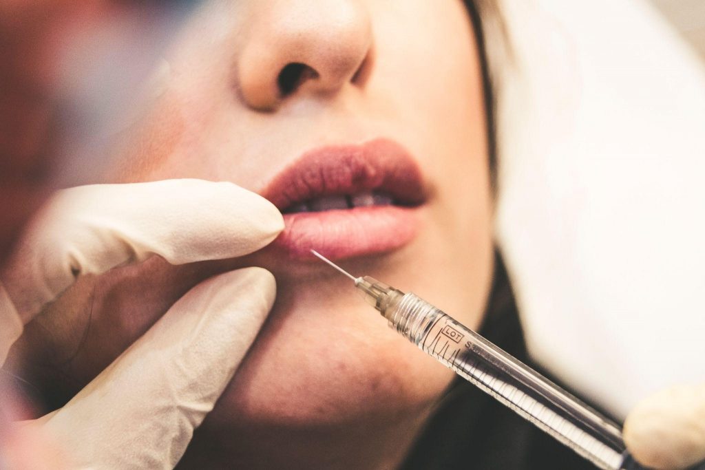 Procedure
Lip injections
filler